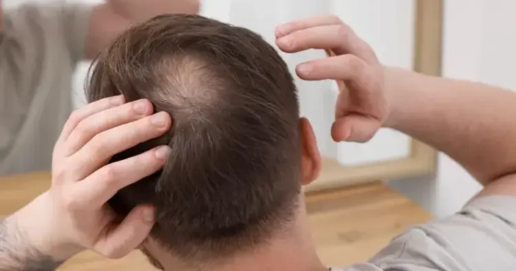 Kronenhairtransplantation